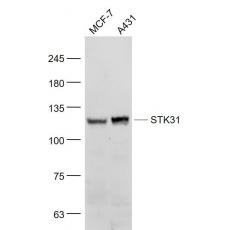 Anti-STK31 antibody