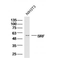Anti-SRF antibody