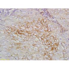 Anti-STEAP1 antibody