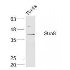 Anti-Stra8 antibody
