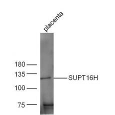 Anti-SUPT16H antibody