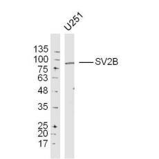 Anti-SV2B antibody
