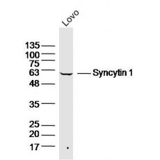 Anti-Syncytin 1 antibody