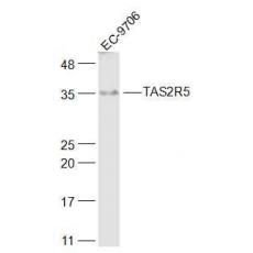 Anti-TAS2R5 antibody