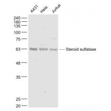 Anti-Steroid sulfatase antibody