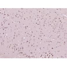 Anti-Styk1 antibody