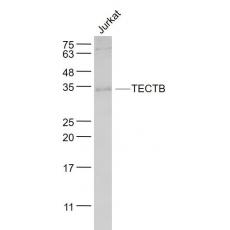 Anti-TECTB antibody