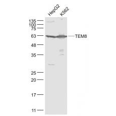 Anti-TEM8 antibody