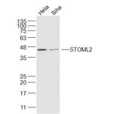 Anti-STOML2 antibody