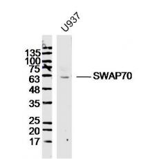 Anti-SWAP70 antibody