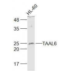Anti-TAAL6 antibody