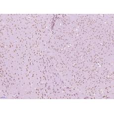 Anti-TATA binding protein TBP/TBP antibody