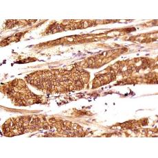 Anti-TEM1 antibody