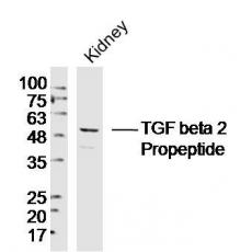Anti-TGF beta 2 antibody
