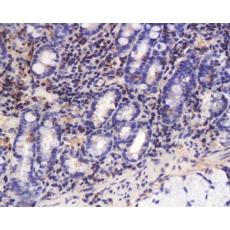 Anti-TGF beta 3 antibody