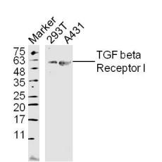 Anti-TGF beta Receptor I antibody