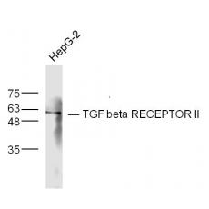 Anti-TGF beta Receptor II antibody