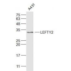Anti-TGFB4/LEFTY2 antibody