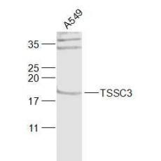 Anti-TSSC3 antibody