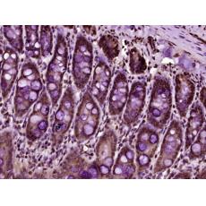 Anti-TUG antibody