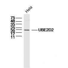 Anti-UBE2D2 antibody