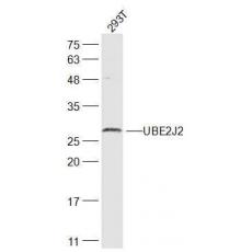 Anti-UBE2J2 antibody