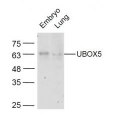 Anti-UNCX antibody