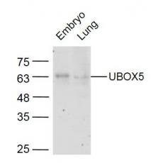 Anti-Uromucoid antibody