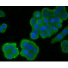 Anti-EGFR antibody