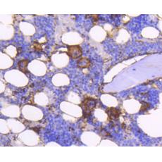 Anti-Integrin beta-3 (CD61 antigen) antibody