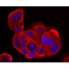Anti-NM23 antibody