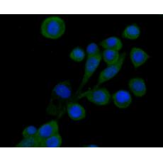 Anti-SNAIL antibody