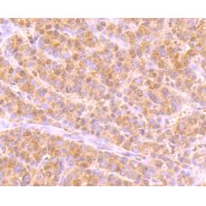 Anti-USP36 antibody