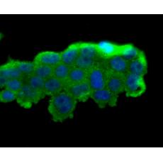 Anti-PRTN3 antibody