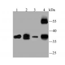 Anti-WNT2 antibody