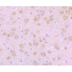 Anti-NaV1.8 antibody