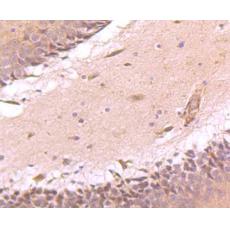 Anti-ATF6 antibody