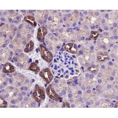 Anti-ERK2 antibody