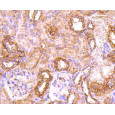 Anti-CD71 antibody