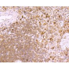 Anti-MMP9 antibody