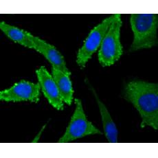 Anti-NaV1.7 antibody