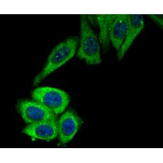 Anti-ROCK2 antibody