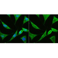 Anti-PTEN antibody