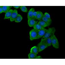 Anti-LOX-1 antibody