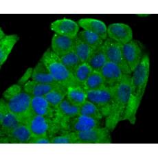 Anti-NaV1.7 antibody