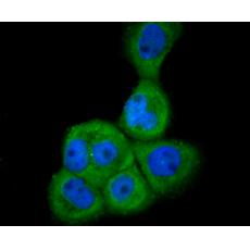 Anti-GRP78 antibody