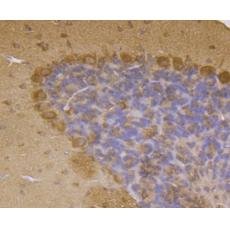 Anti-LRRK2 antibody