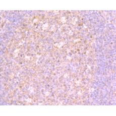 Anti-4E-BP1 antibody