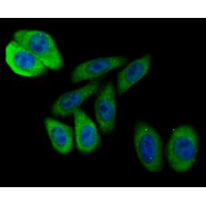 Anti-BCL2 antibody