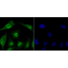 Anti-FBXW7 antibody